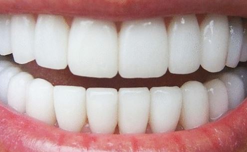best cosmetic teeth