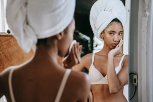 hyperpigmentation